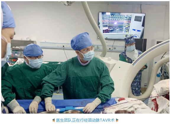 全球首例我院完成一例经颈动脉tavrtevarpbaca一站三式手术