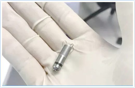 世界最小心脏起搏器——我院完成粤东,西,北首例无导线起搏器植入