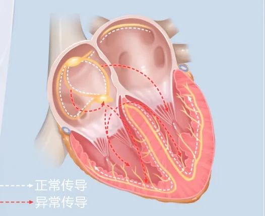 升学,入职体检不过关?心脏突然"小鹿乱撞"是怎么回事?